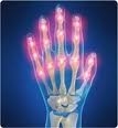 Arthritis Relief